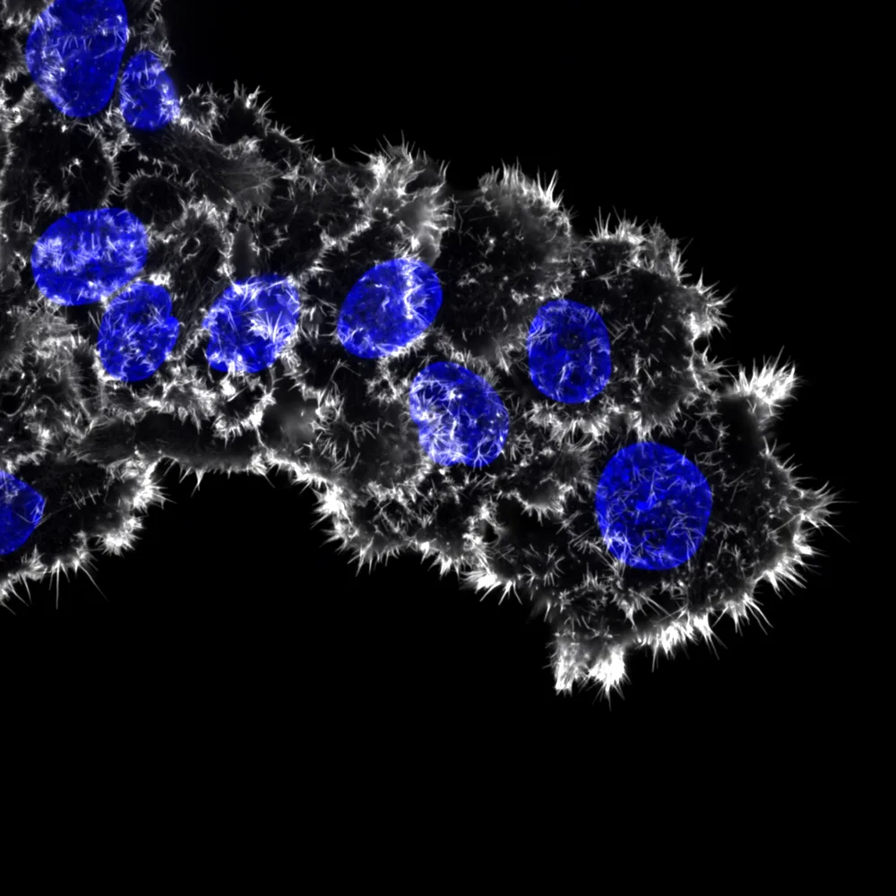FiloQuant reveals increased filopodia density during breast cancer progression