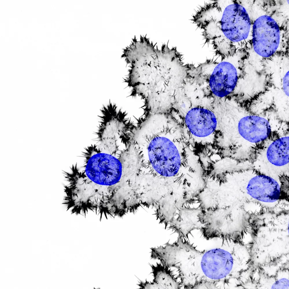 Filopodia Quantification Using FiloQuant