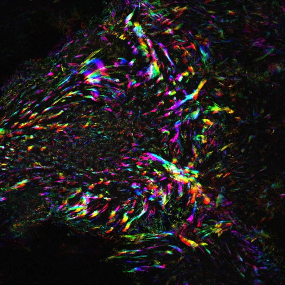 Image: Time projection illustrating the dynamics of focal adhesions in human endothelial cells.
