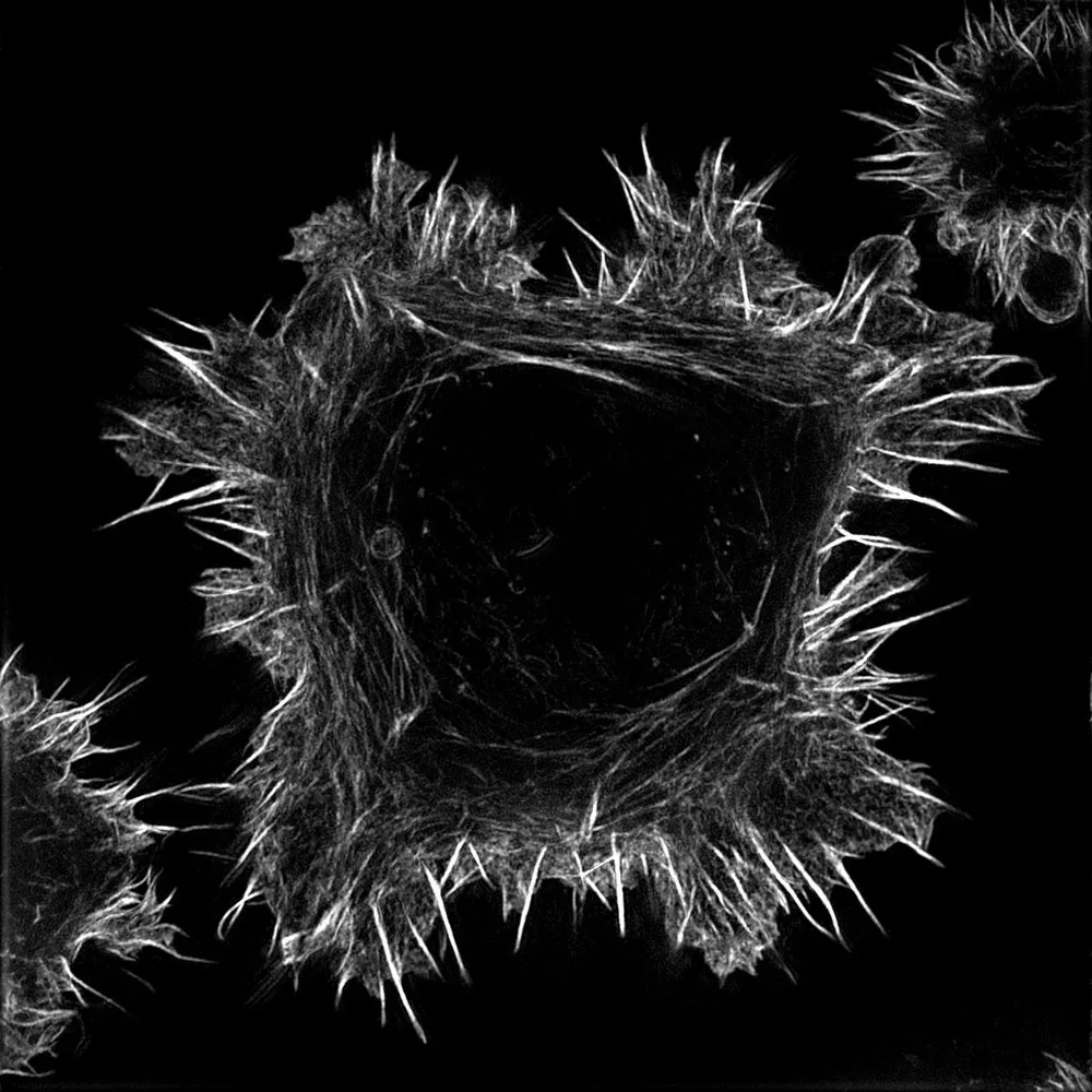 Image: Cancer cell labelled for F-actin.