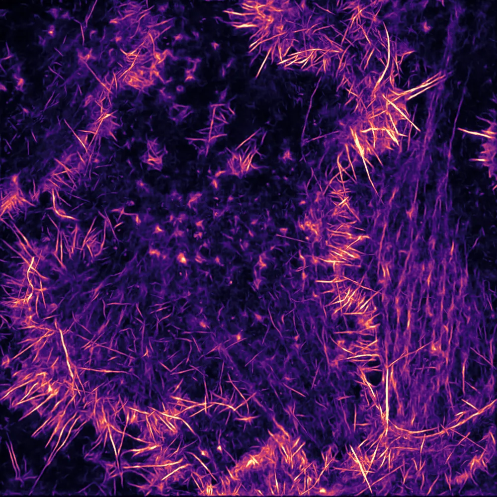 Deep learning to analyse microscopy images