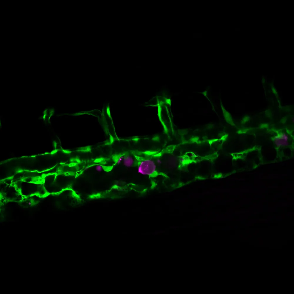 Image: A cancer cell (magenta) inside the vasculature of a zebrafish embryo.