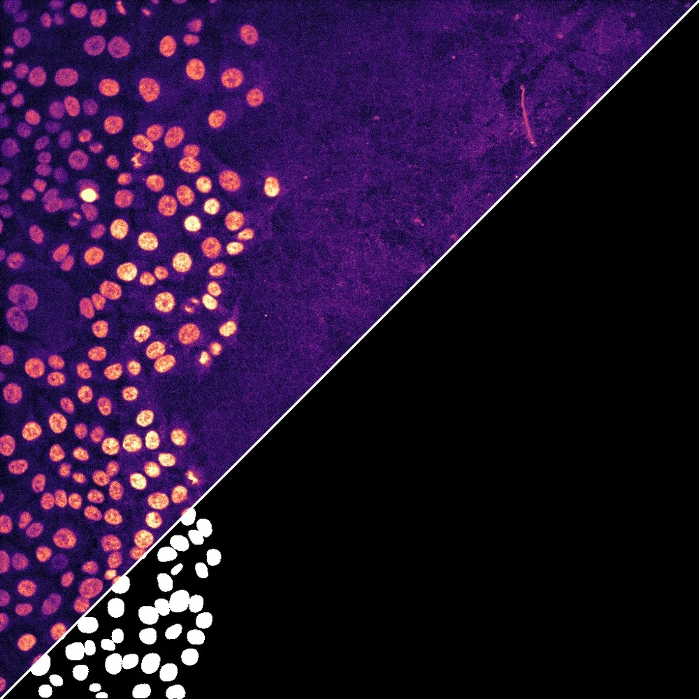 Square image split along the diagonal: on one side a microscopy image of cell nuclei in a migrating monolayer, in orange on purple, on the other the white nuclear masks predicted from it by a deep-learning segmentation model.
