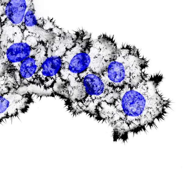 Breast cancer cells invading through collagen. The actin cytoskeleton (white) and the nuclei (blue) are labelled.