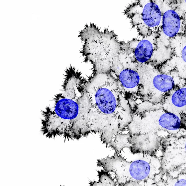 Breast cancer cells invading through collagen. The actin cytoskeleton (black) and the nuclei (blue) are labelled.