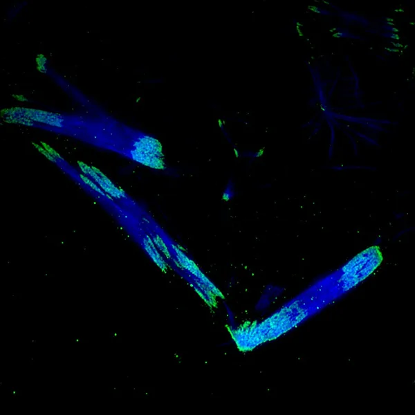 Human embryonic stem cell labelled for paxillin (green) and actin (blue), imaged using structured illumination microscopy.