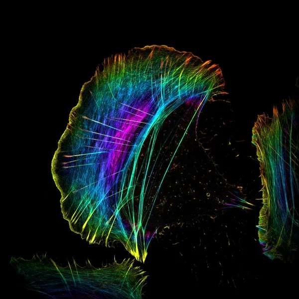 Osteosarcoma cell labelled for actin and imaged using structured illumination microscopy. Colour indicates the z-position.