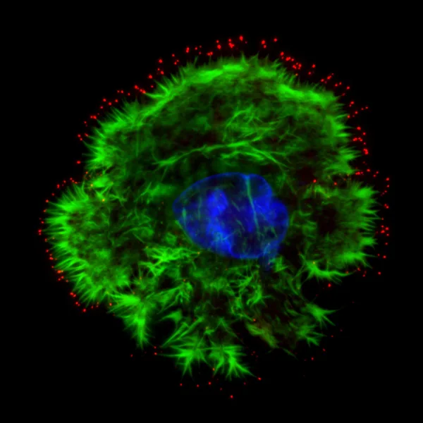 Breast cancer cell labelled for actin (green), Myosin-X (red) and DAPI (blue).