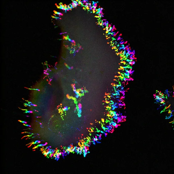 An osteosarcoma cell expressing Myosin-X-GFP was recorded live. The image shows a time projection of the sequence.