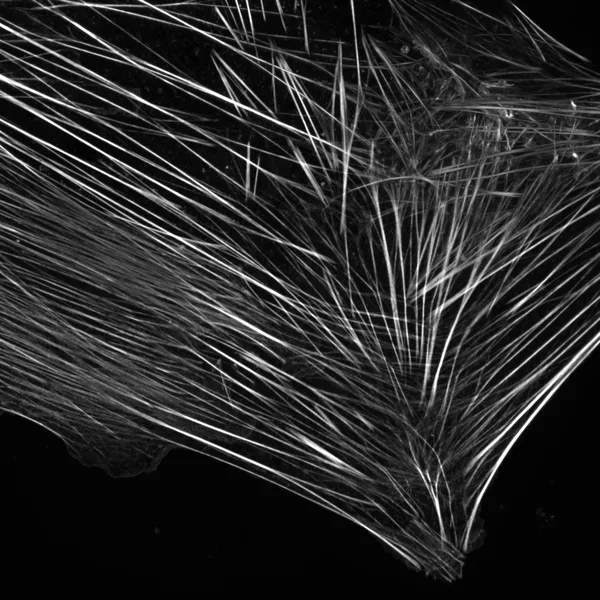 A mammary fibroblast stained for actin