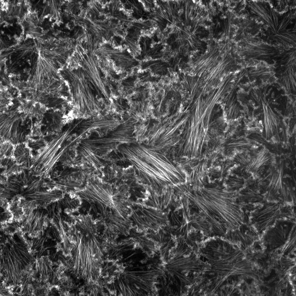 Breast cancer cell monolayer stained for actin.