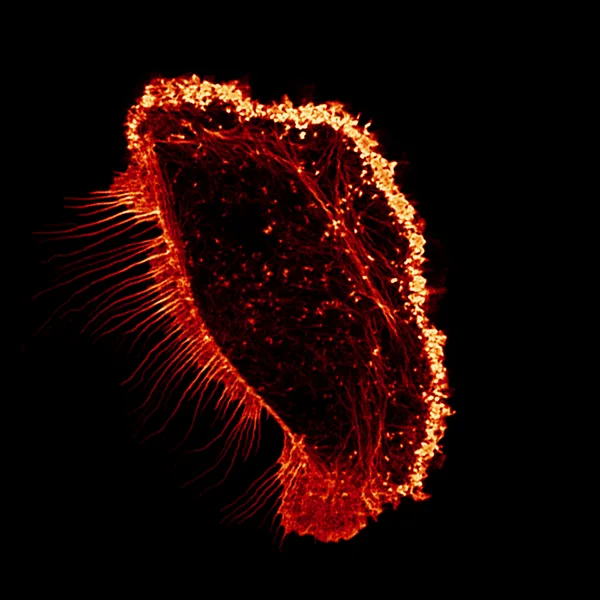 Microscopy image from the Cell Migration Lab