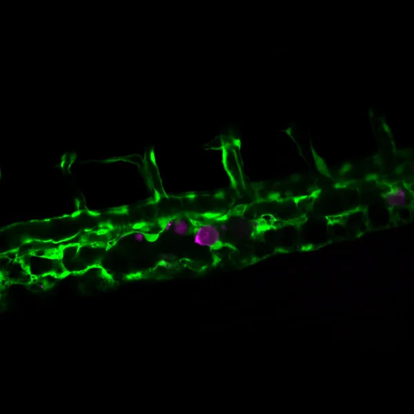 Cancer cells (magenta) migrating inside a blood vessel in a living zebrafish embryo (green).