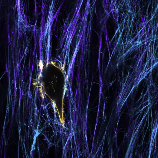 Microscopy image from the Cell Migration Lab