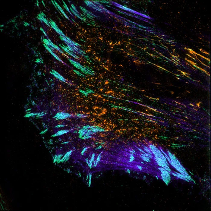 Cell matrix adhesion in cell migration