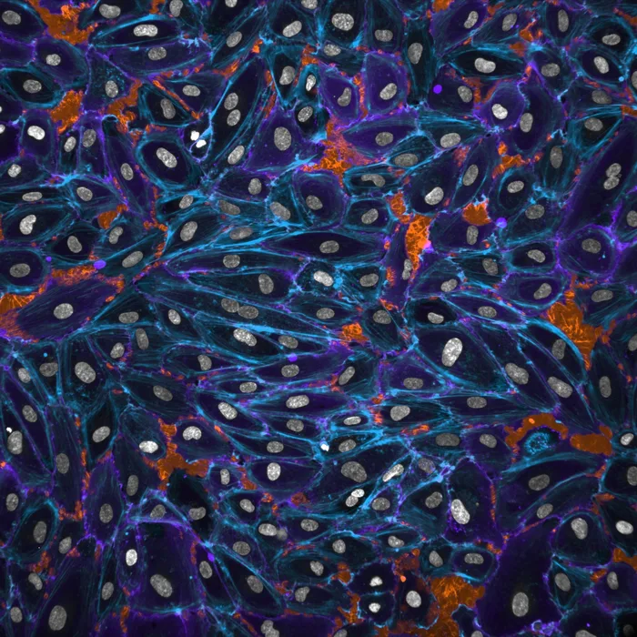 TLNRD1 is a CCM complex component and regulates endothelial barrier integrity