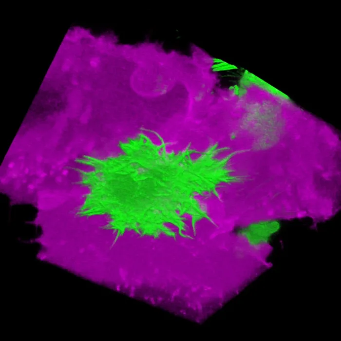 3D reconstruction of a MIA PaCa-2 pancreatic cancer cell, in green with many filopodia-like protrusions, crossing an endothelial monolayer shown in magenta, imaged with Airyscan microscopy. Image by Sujan Ghimire.