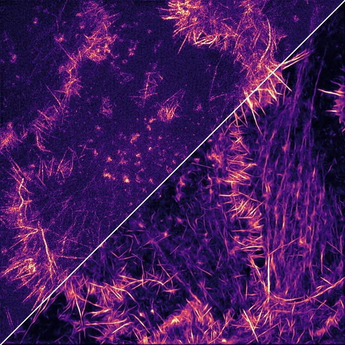 Square image split along the diagonal: a noisy fluorescence microscopy image of a cell with many fine actin protrusions on one side, and the same field after denoising by a deep-learning model, with cleaner and sharper protrusions, on the other.