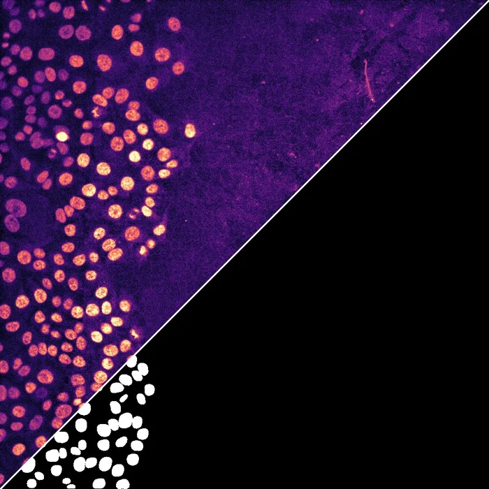 Square image split along the diagonal: on one side a microscopy image of cell nuclei in a migrating monolayer, in orange on purple, on the other the white nuclear masks predicted from it by a deep-learning segmentation model.