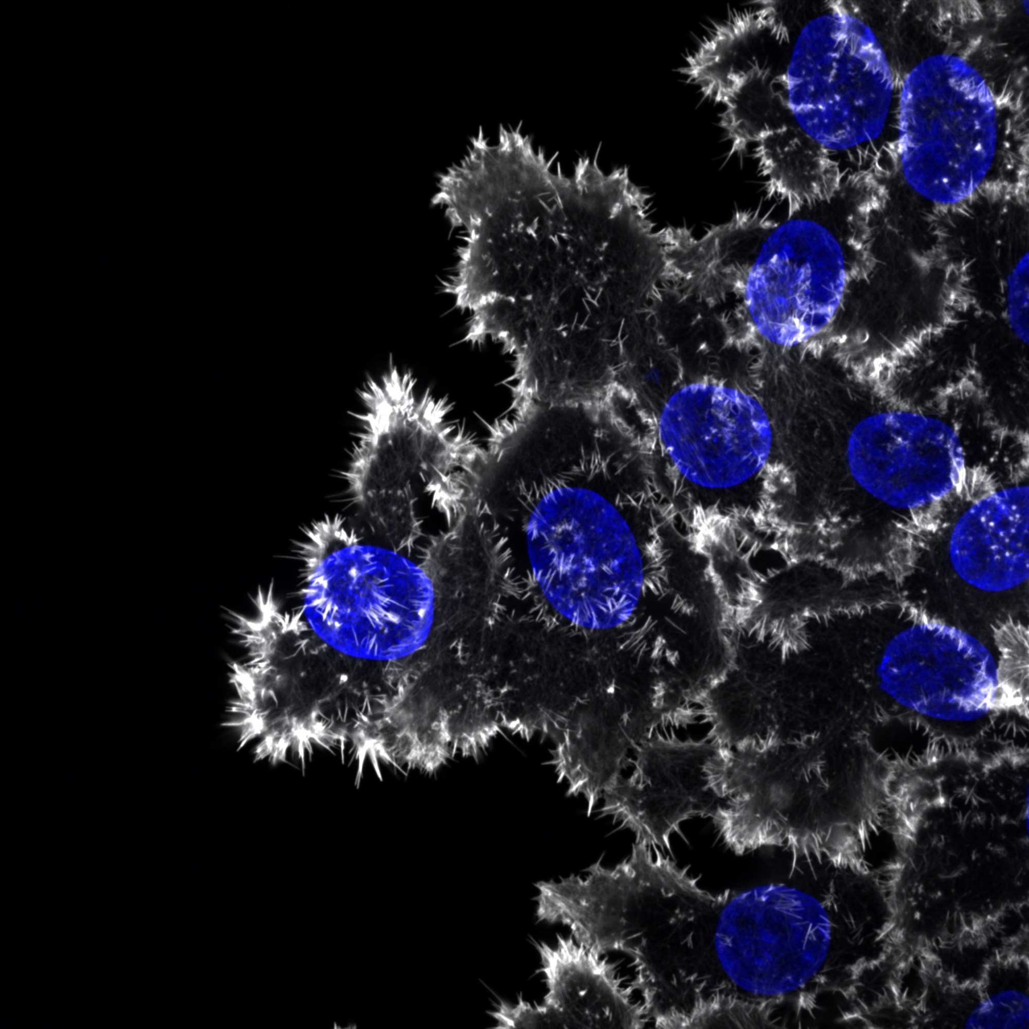 Breast cancer cells invading through collagen. The actin cytoskeleton (white) and the nuclei (blue) are labelled.