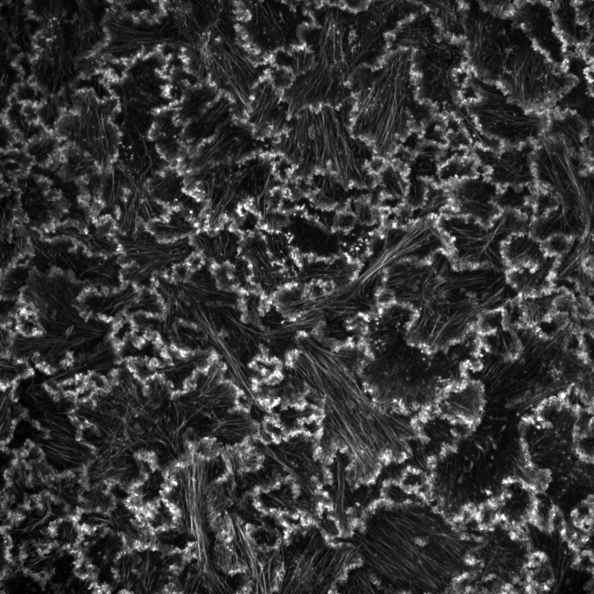 Breast cancer cell monolayer stained for actin.