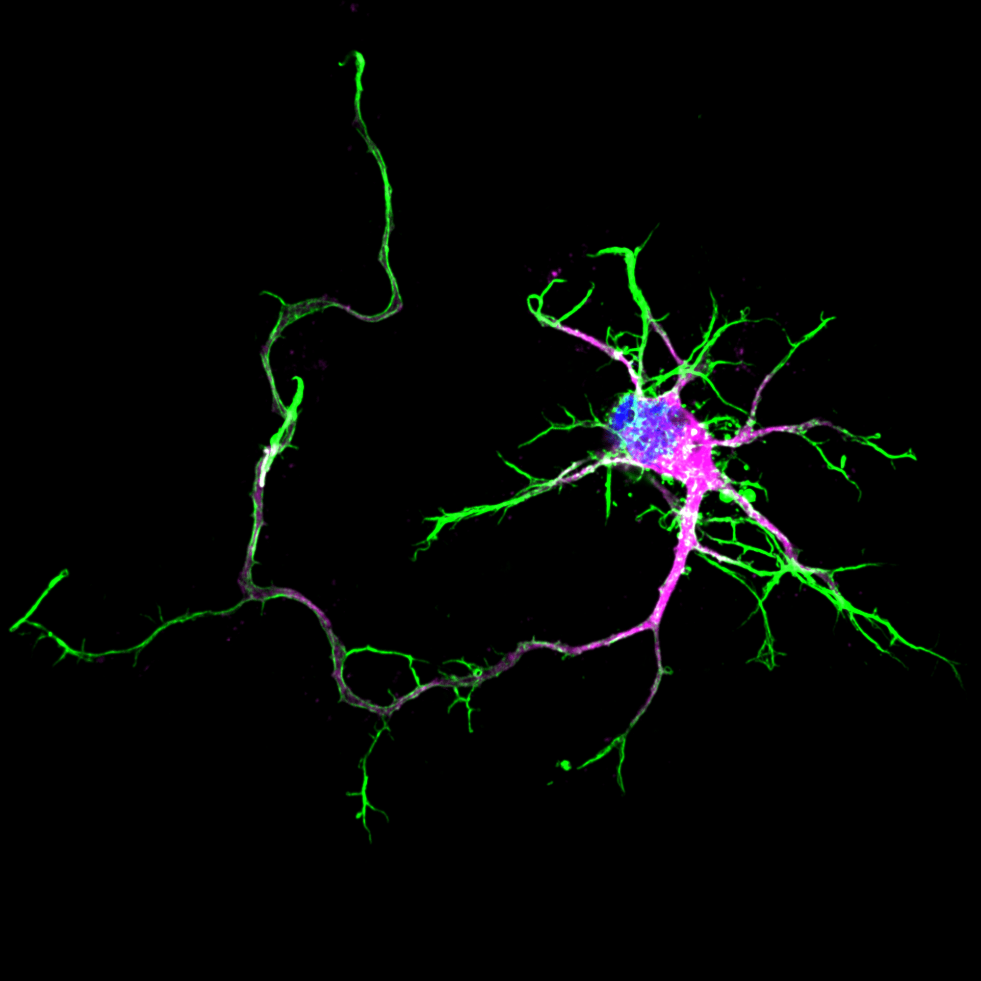 Rat neuron stained for actin (green), MAP2 (magenta) and DAPI (blue).