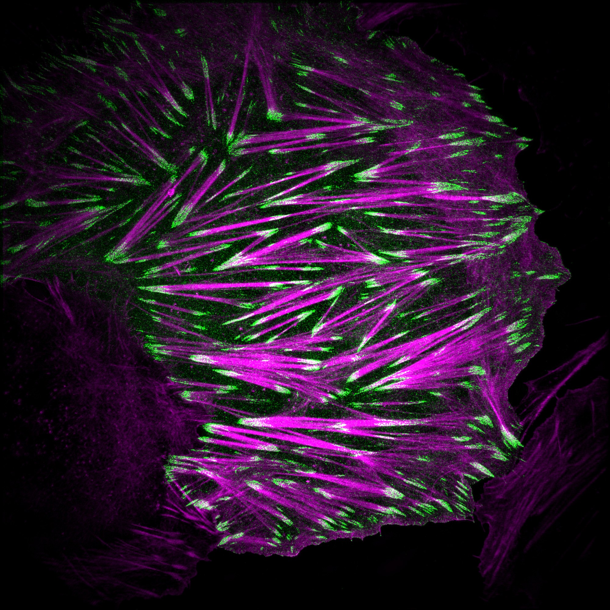 An osteosarcoma cell labelled to visualize the actin cytoskeleton (magenta) and paxillin (green). Image acquired using a structured illumination microscope.