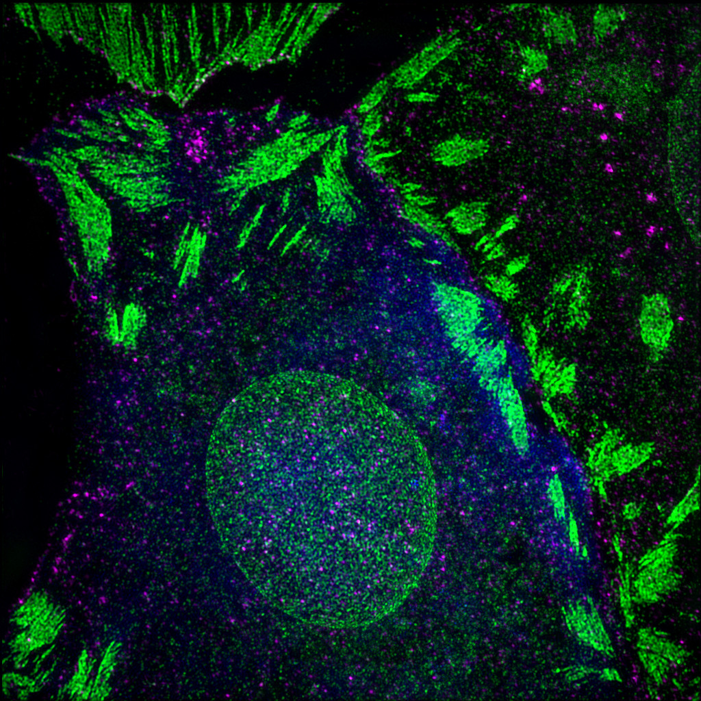 A fibroblast stained for active integrin (green) and Arp2/3 (magenta). Image acquired using a structured illumination microscope.