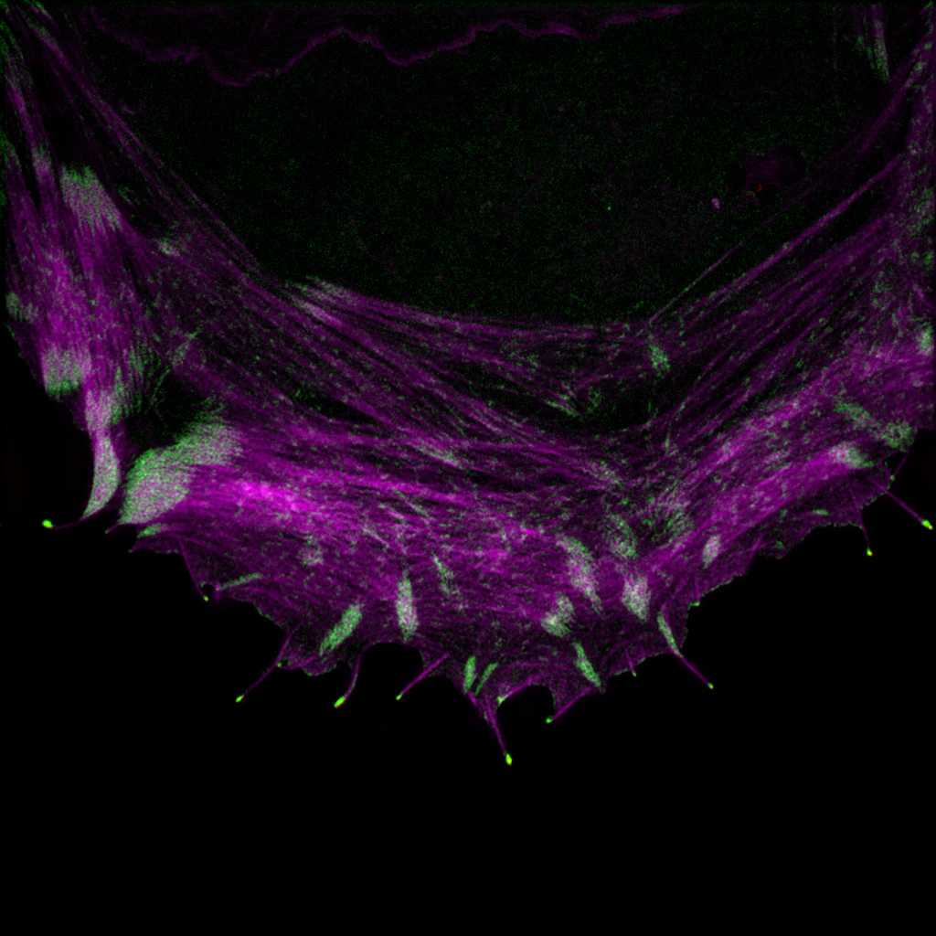 An osteosarcoma cell labelled to visualize the actin cytoskeleton (magenta) and VASP (green).