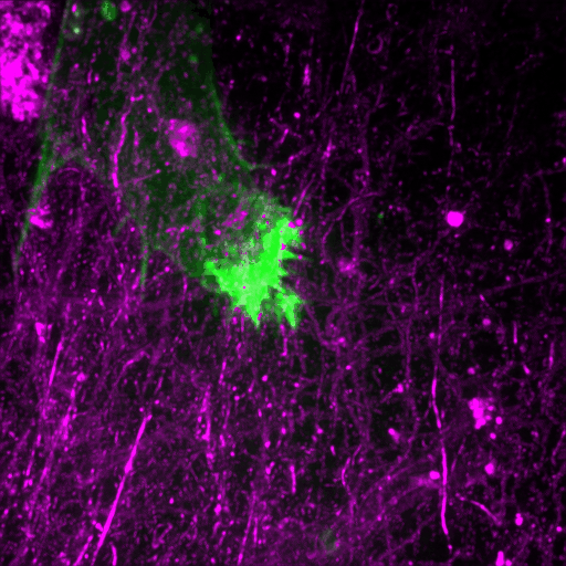 Filopodia in cell adhesion, 3D migration and cancer cell&nbsp;invasion