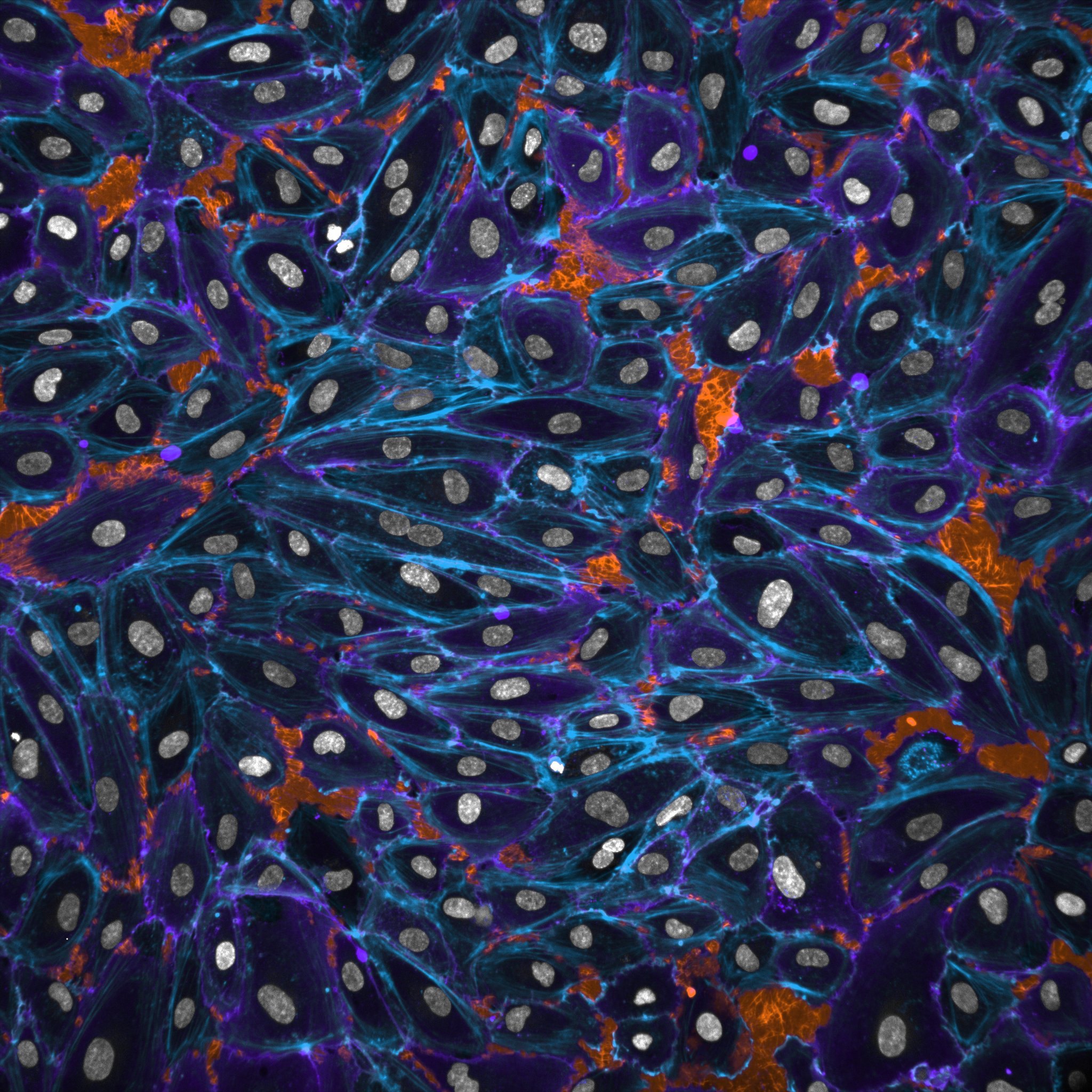 CELL MIGRATION LAB – We study cell migration in health and disease