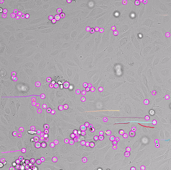 Fast label-free live imaging reveals key roles of flow dynamics and CD44-HA interaction in cancer cell arrest on endothelial&nbsp;monolayers